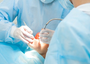 Dentist placing dental implants in North Dallas in patient’s mouth