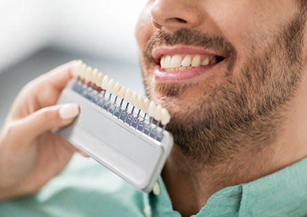 Man's smile compared with porcelain veneer color chart