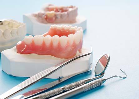 a plaster model of a mouth with full dentures