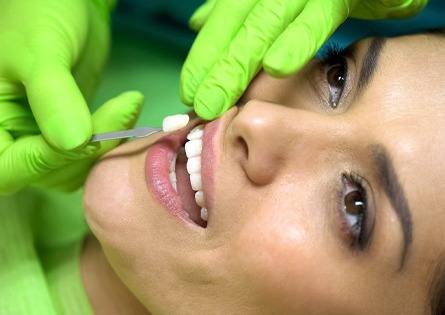 woman smiling receiving porcelain veneers