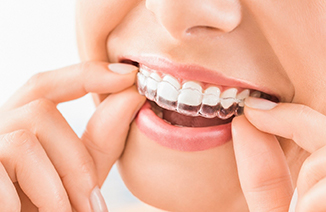 Patient placing clear aligner tray