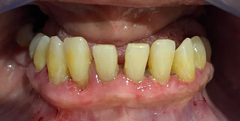 Mouth with slightly gapped and yellowed teeth