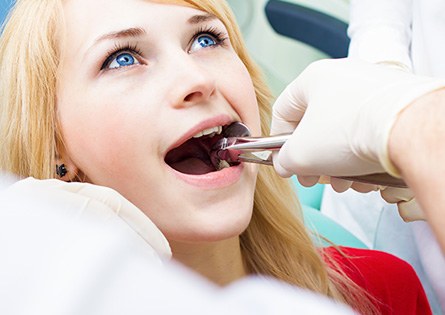 Woman having tooth extracted
