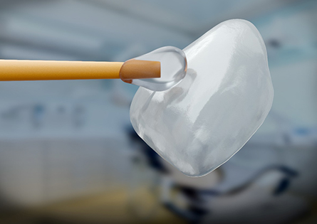 A close up of a dental veneer with an applicator