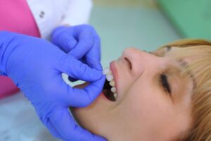 Veneers being applied to patient's tooth.