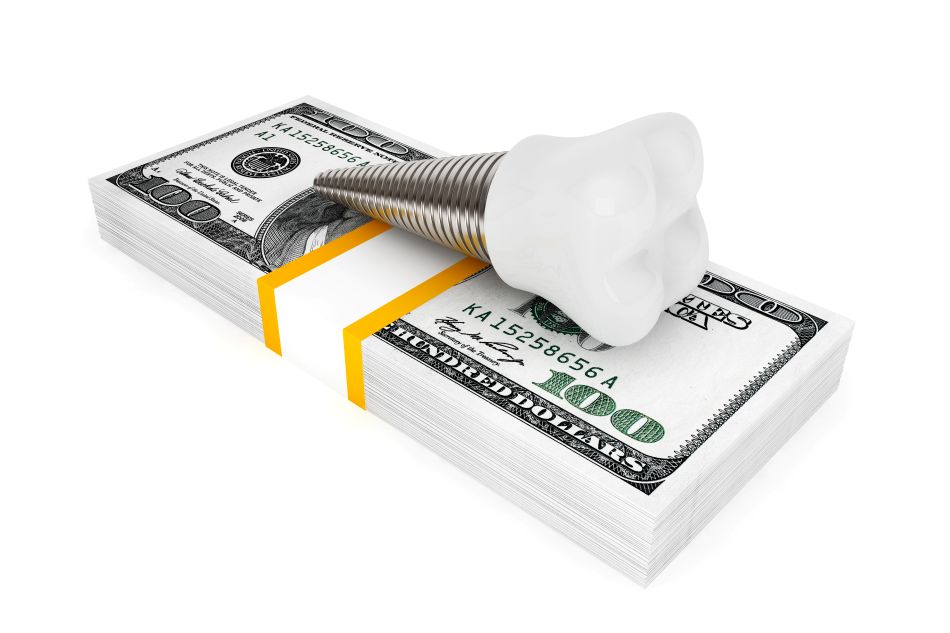 A computer-generated image of a dental implant on a stack of money